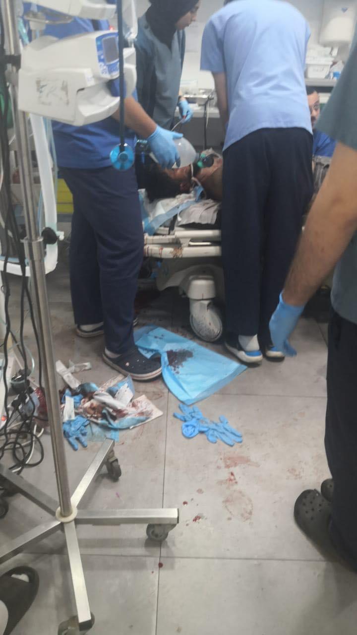 شاب ضحية حادث سير على أوتوستراد أنفه... سيارة تصدم دراجته وفرار السائق! (صورة)